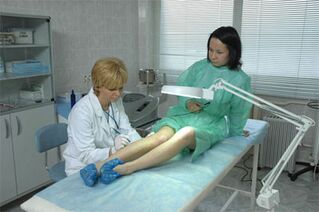 Bacaklardaki varisli damarlar için lazer tedavisi