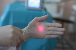 varisli damarların lazer tedavisine nasıl hazırlanılır