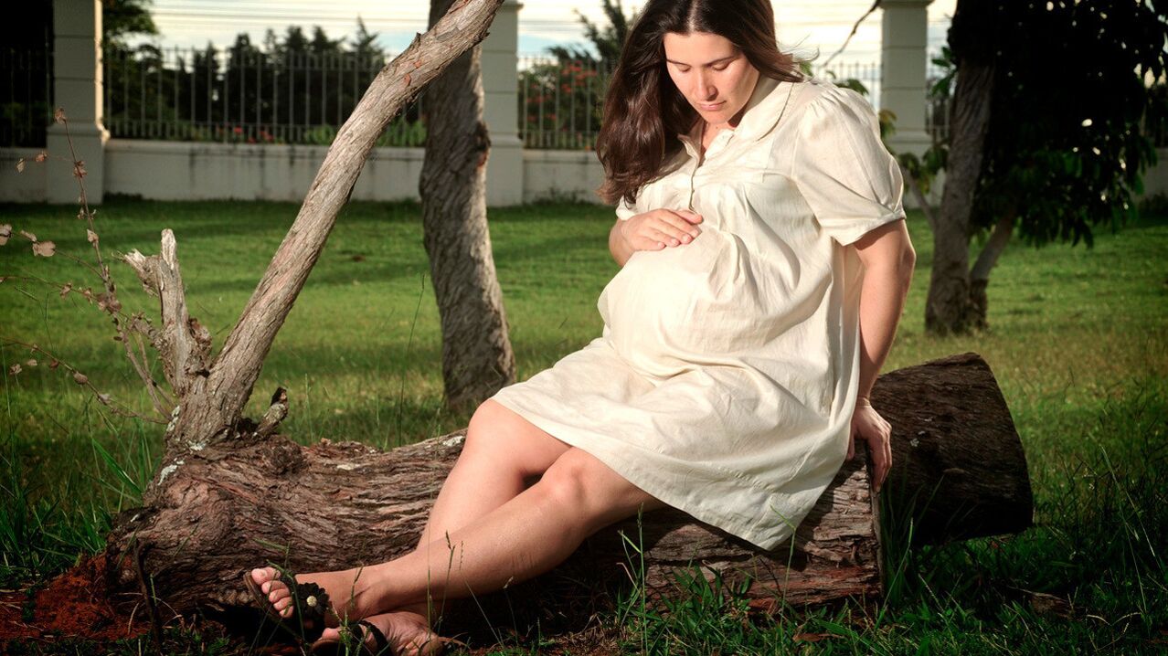 Hamilelik bacaklarda varis gelişiminde bir faktördür