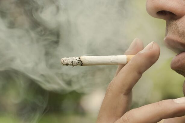 Sigara, retiküler varisli damarların gelişmesinin nedenlerinden biridir. 